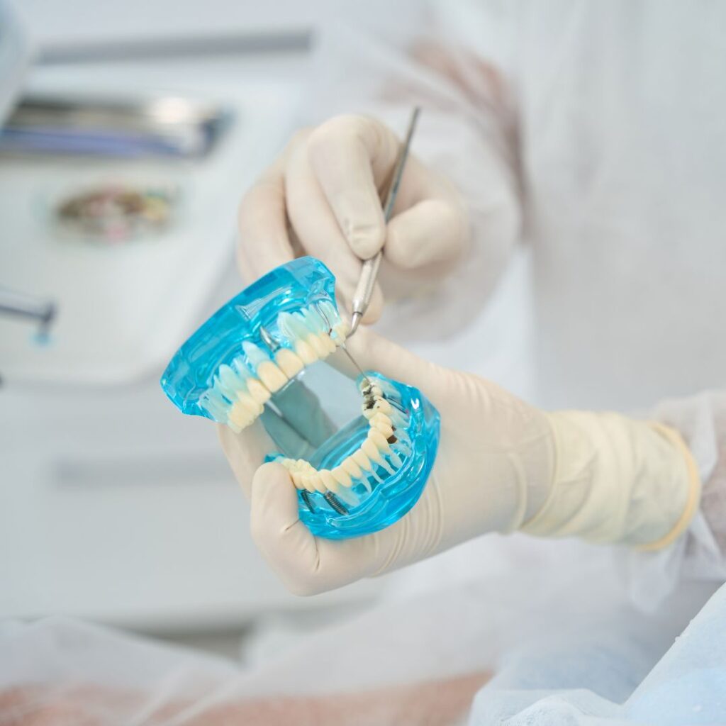 Implantes dentales en Churriana de la Vega